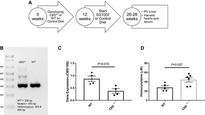 Hydrogen Sulfide Ameliorates Homocysteine-Induced Cardiac Remodeling and Dysfunction